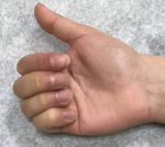 Hand Reconstruction